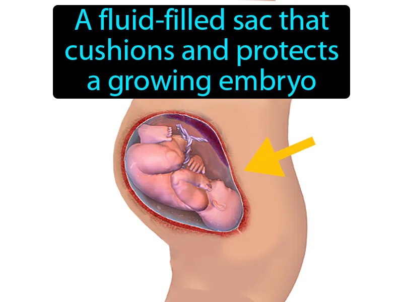 Amniotic sac Definition