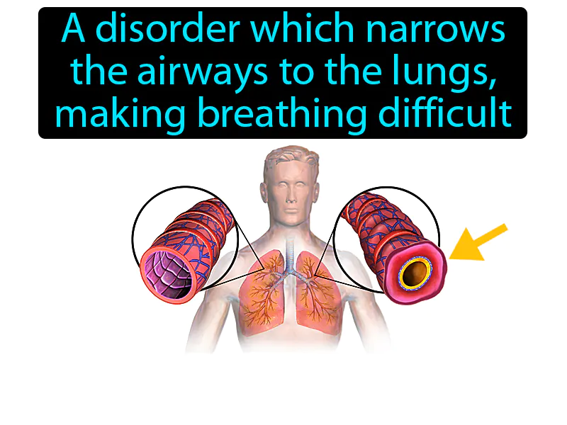Asthma Definition