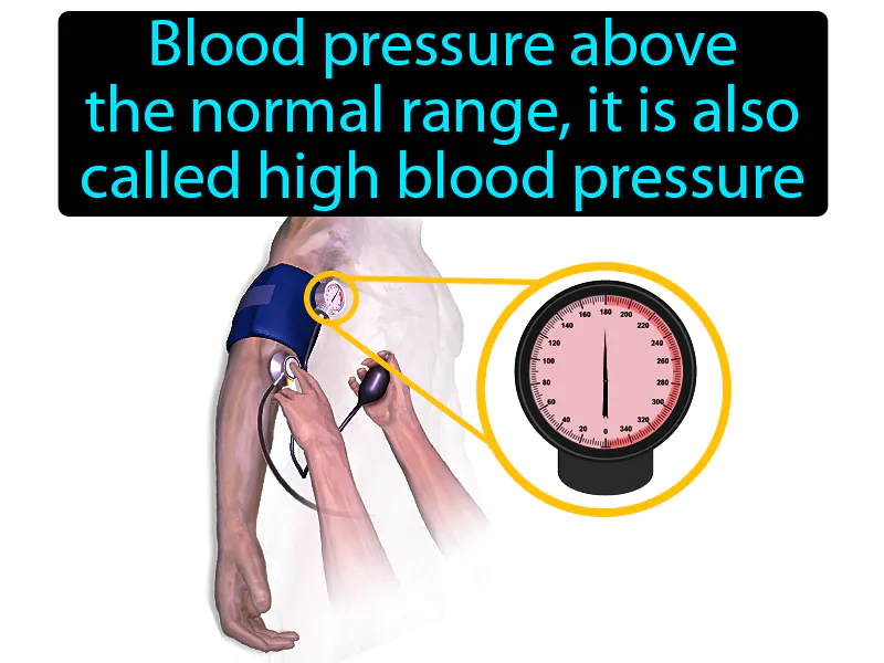 Hypertension Definition